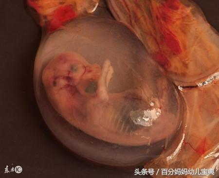 被堕胎出来胎儿还有呼吸,医生这种做法,难道孕妈不心痛吗?