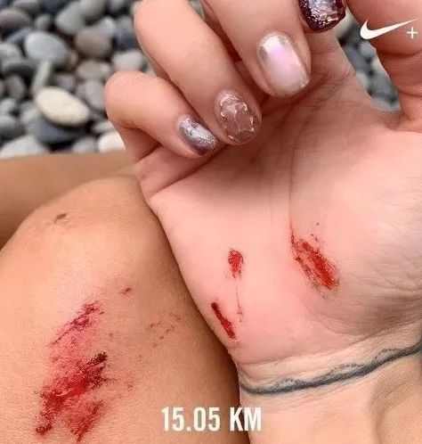 44岁歌神之妻晒跑步受伤照惹网民心痛 曾豪言:死都要跑步!