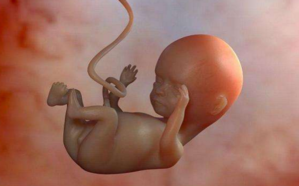 胎儿脐带绕颈比较常见要注意这五种避免造成更多危害