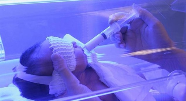 "十个婴儿九个黄,都要住院照蓝光",新生儿黄疸有那么可怕吗?