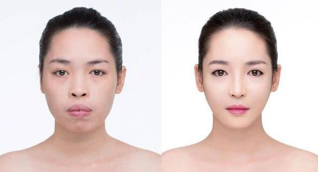 龅牙妹整容成功后人生逆袭,不仅事业有成还经常被邀请去拍广告