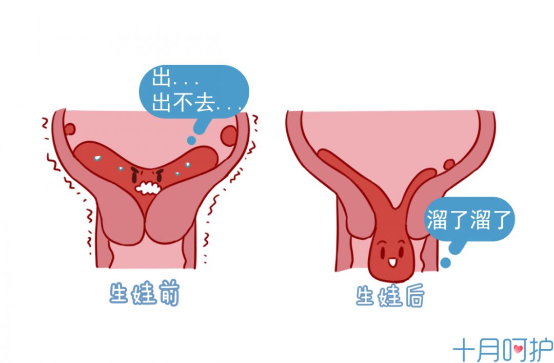 妈妈要是痛经生的女儿也会痛经生的儿子会得疝气是真的吗