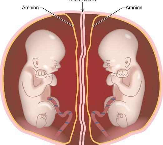 两个宝宝会长得很像,而且性别相同;如果是异卵双胞胎,长像可能较为不