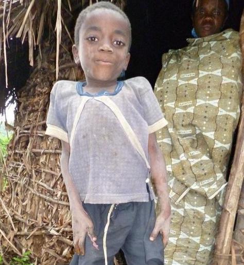 非洲"小矮人"部落:发育速度极快,8岁就能生儿育女!