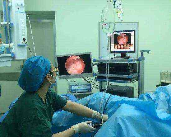 妇科手术高清图 人流图片