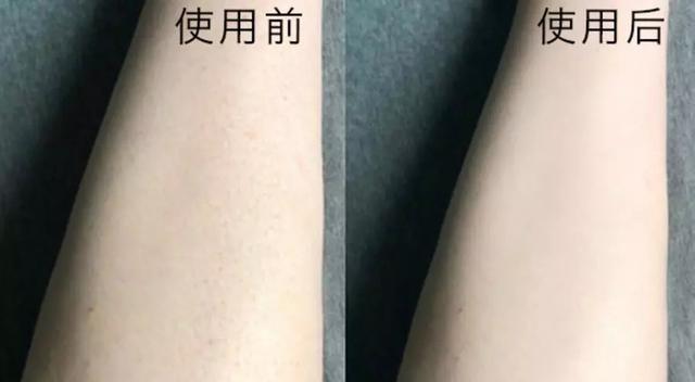 腋下鸡皮肤有味吗(腋下皮肤像鸡皮一样) 腋下鸡皮肤有味吗(腋下皮肤像鸡皮一样)