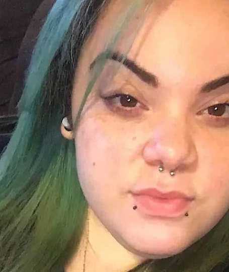 24岁女孩满脸胡须被人叫去死男友却喜欢她的美丽