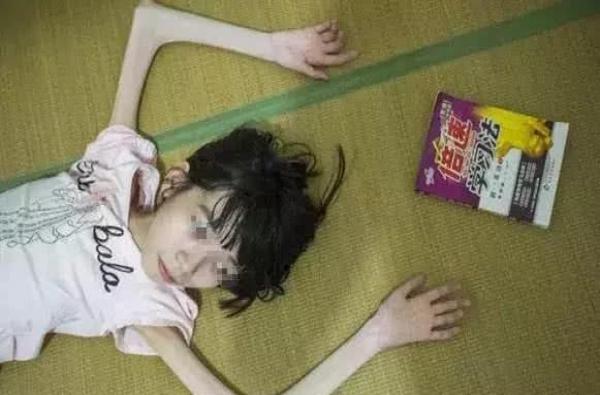 筷子腿 12岁恐怖图片
