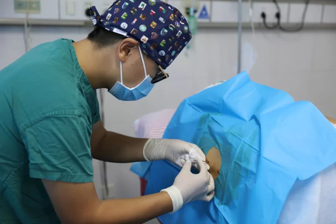 无痛分娩即将全国推广好处这么多但四类孕妈无福享受