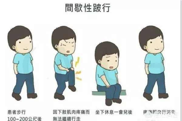 间歇性跛行是怎么回事,什么原因引起来的呢?