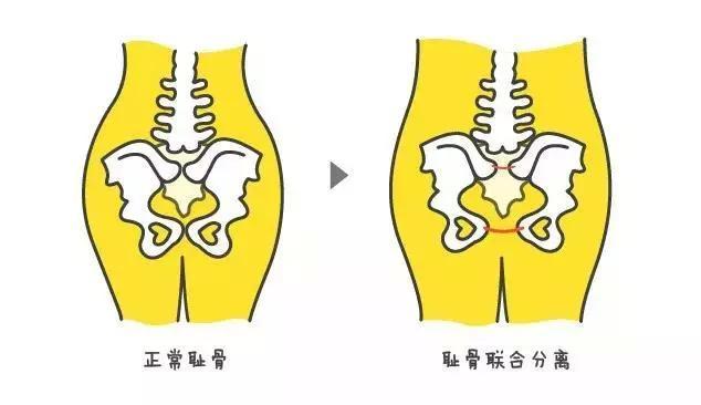 孕妇|耻骨|怀孕_新浪新闻