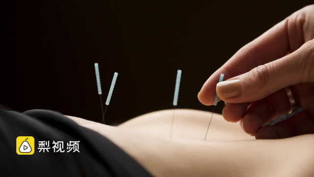 针灸纳入美国医保!全美人民喜大奔普:终于等到