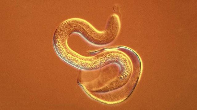 正文       常见的寄生虫种类   常见的寄生虫包括蛲虫,蛔虫,十二指肠