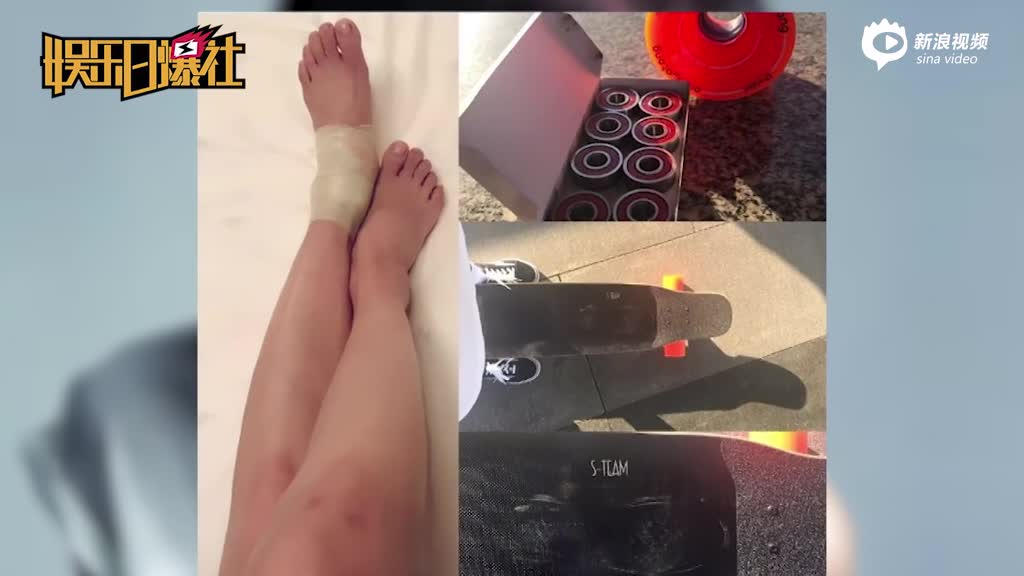 王珞丹从滑板掉落脚踝受伤