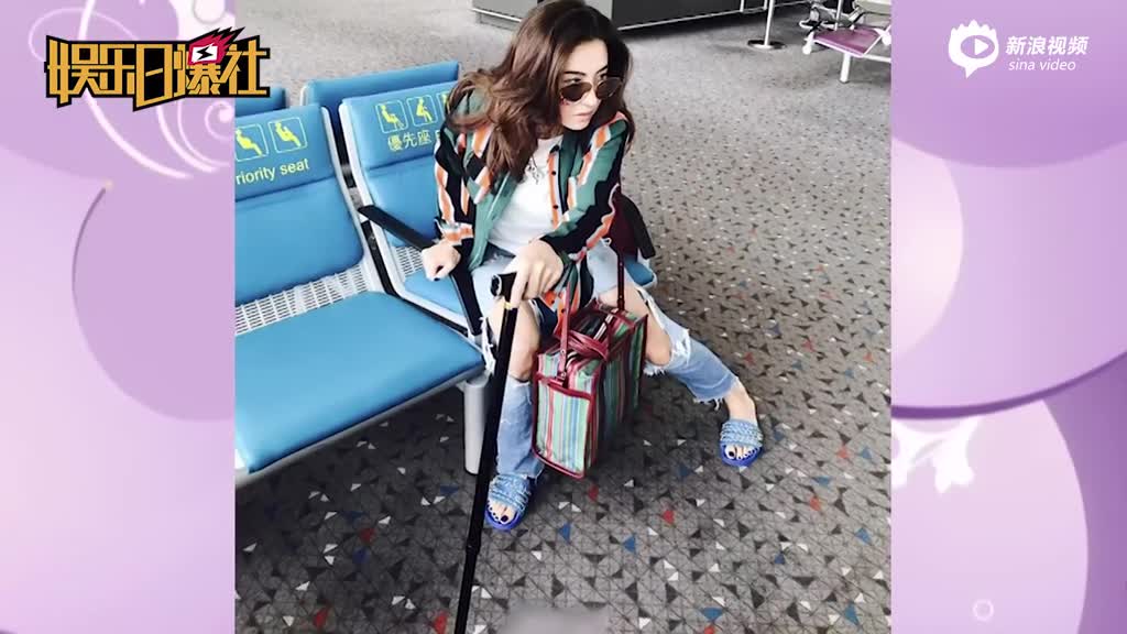 视频：张柏芝拄拐杖瘫坐在椅子上 脚缠绷带惹网友心疼