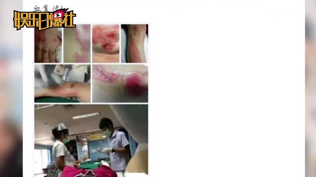 摄影师曝薛之谦曾设想与李雨桐结婚 女方曾大出血