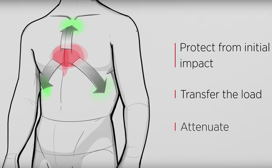 迈凯伦碳纤维护甲：武装到胸口的车辆被动安全
