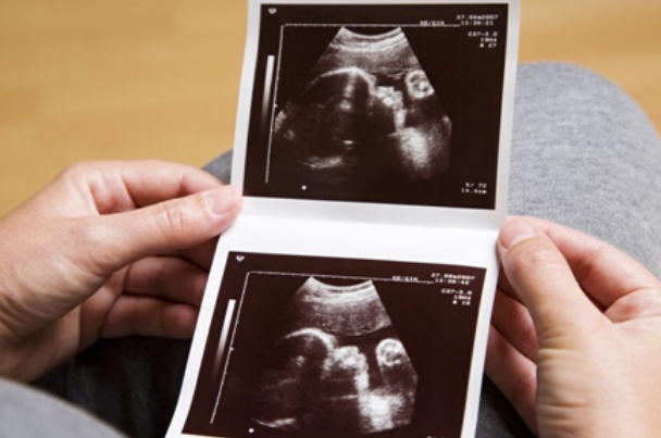 怀孕期间,孕妇有必要做四维彩超吗?做四维彩超,有什么用呢?