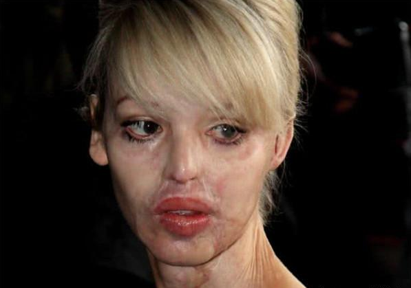 英国女美女主持人,十年前遭人泼硫酸,低谷时遇见真爱如今复出!