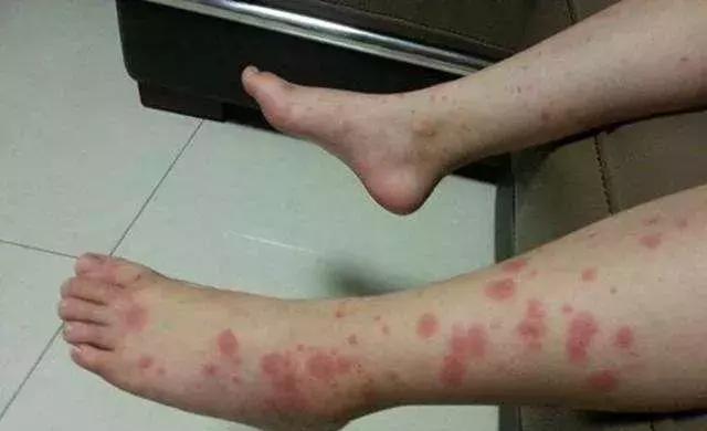 一周不晒被子上亿螨虫陪你一起安眠卧室放ta轻松除螨