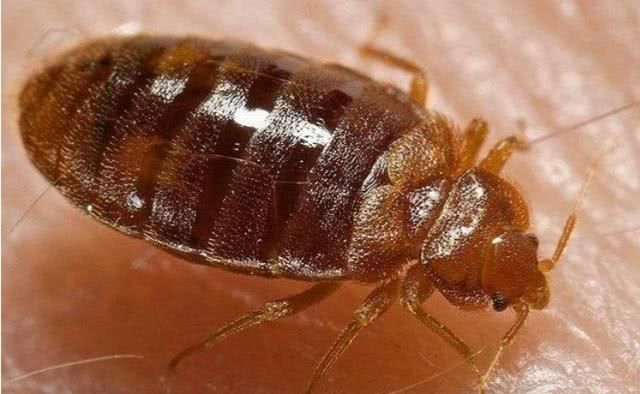 80后很多人长虱子,为何现在没有了?看完后忍不住鼻子发酸