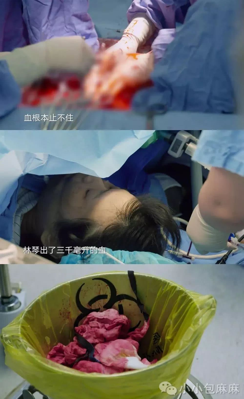 3分钟剖腹产视频曝光哪个女人不是在用命生孩子