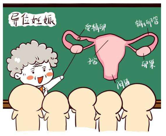 异位妊娠是怎么回事?宫外孕究竟是什么原因造成的?