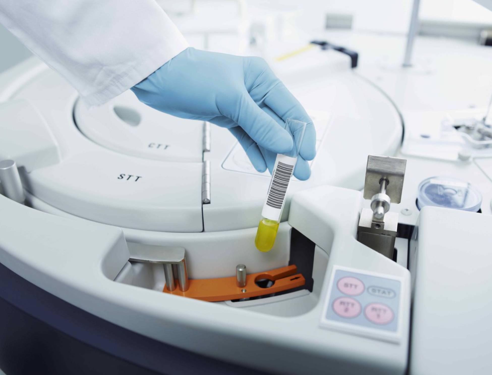 第三代试管婴儿技术能帮助患者筛查哪些疾病