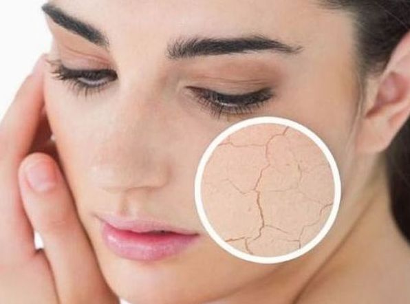 皮肤很干燥怎么改善呢?