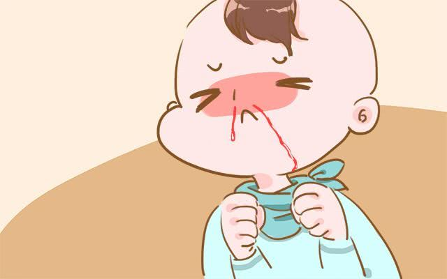 宝宝流鼻血,赶快仰头塞纸巾,其实这种做法是错误的!