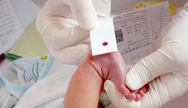 采集新生儿足跟血用于遗传性耳聋基因筛查（受访者供图）