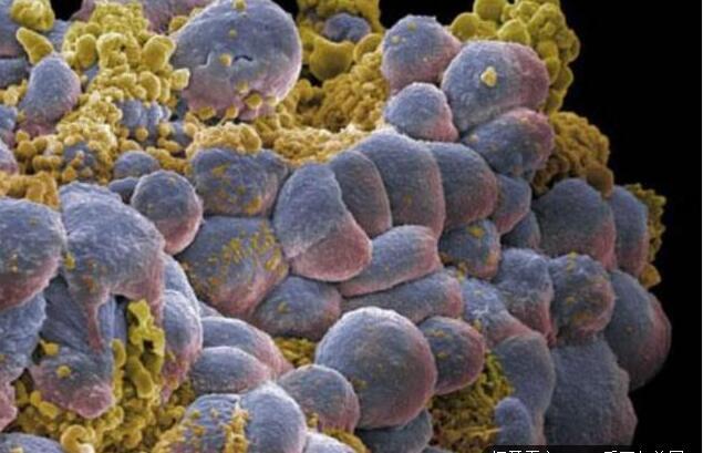 癌细胞|癌症|韭菜_新浪新闻