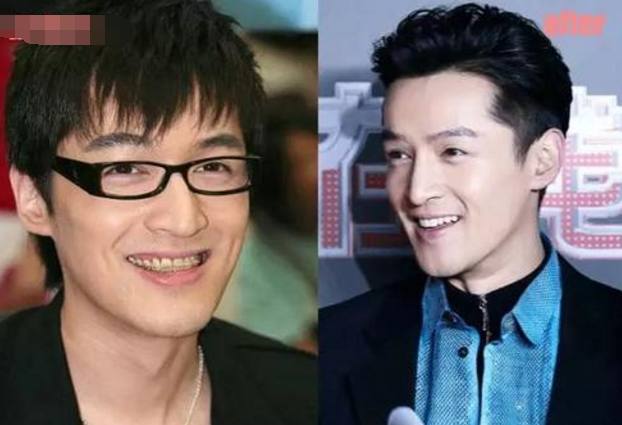 娱乐圈整过牙的7大男星胡歌和霍建华上榜他是丑牙第一人