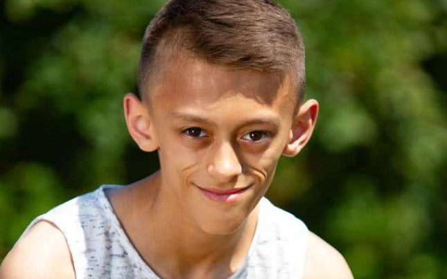 英国男孩患怪病吃再多也无法变胖,眼大脸尖被称为"外星人"