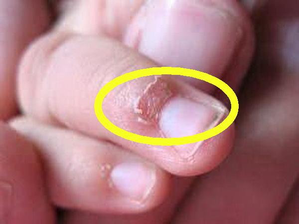 孩子手上长倒刺是身体缺啥吗原来通过手指可以看出这么多秘密