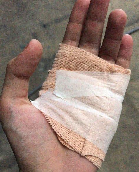 昆凌晒片场受伤照,向老公撒娇说了一句话,周杰伦的举动甜翻了!