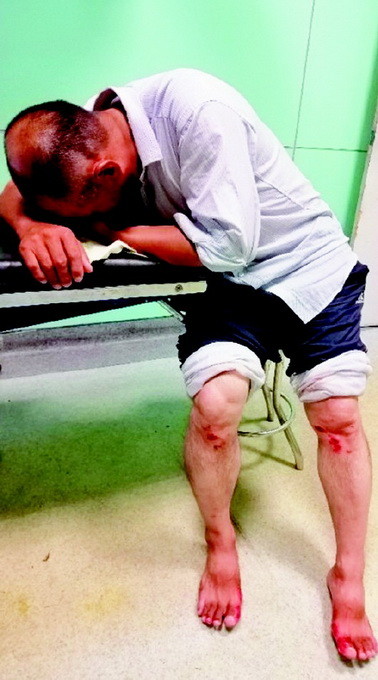 救援员下海营救被困男子 全身多处受伤差点休克