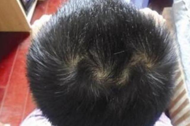 可能很多宝妈不懂,不妨一看