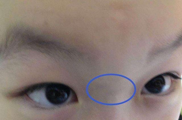 积食的宝宝,脸上最明显的特征就是:脸色黄,鼻子两侧发青,整个人看上去