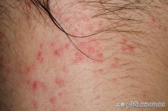 这4个症状,其实是它的"脚步声"