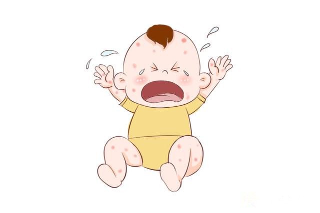 有一种疹子是奶奶说你冷,孩子全身起红疹!