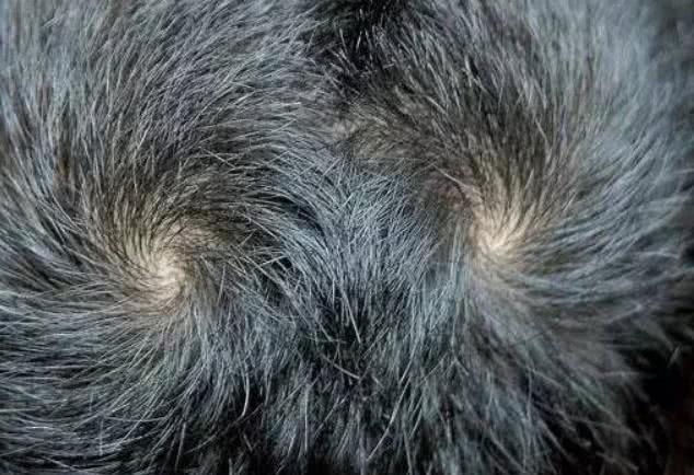 孩子头上有几个旋,和宝宝"性格"有关吗?看完你就明白了!