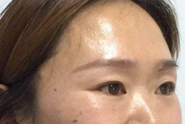 脸上油腻不清爽教你一个妙招效果很好