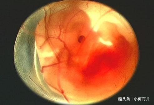 怀孕后"孕吐"越厉害, 胎儿智商更高? 孕妈要心里有数!