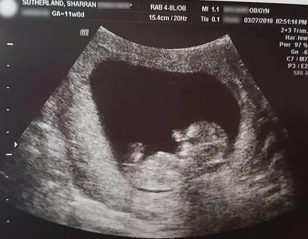 亲妈误杀儿子后跳楼:一个女人对家庭的影响到底有多大?