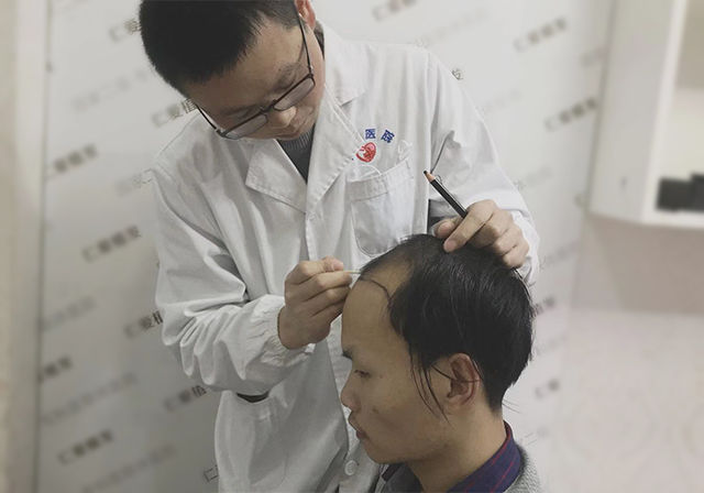 植发是什么原理 能管多久_植发的原理及后遗症