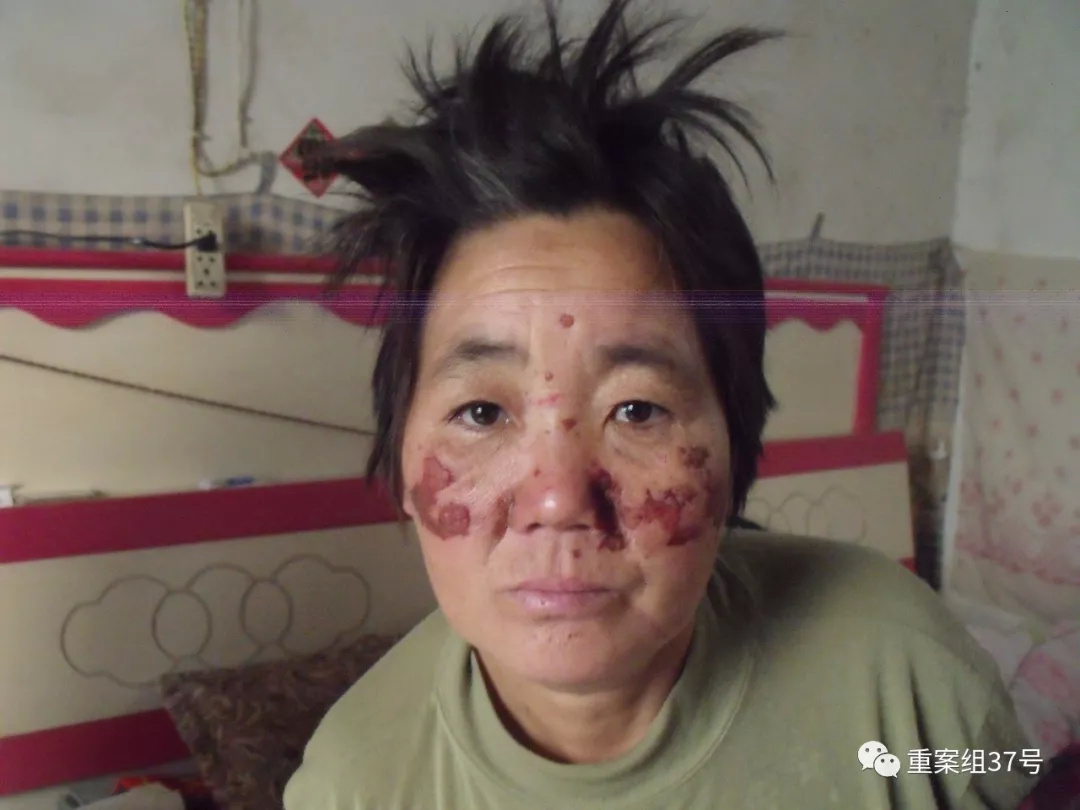 脱光衣服电击,逼人喝尿 | 辱母案背后涉黑团伙的"九宗罪"