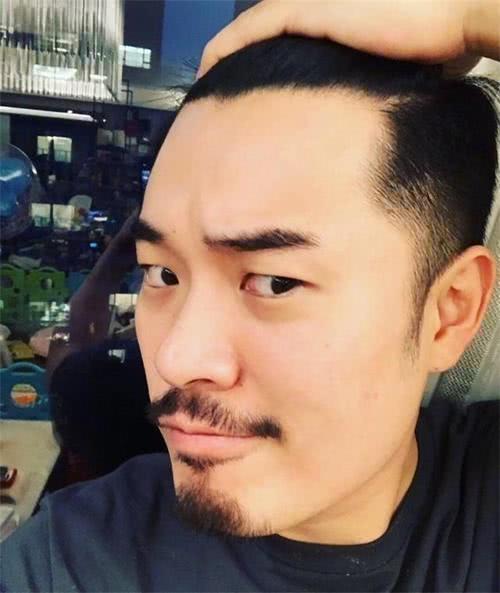 娱乐圈又一位男明星要"秃顶",发际线高的吓人,看起来"真好"