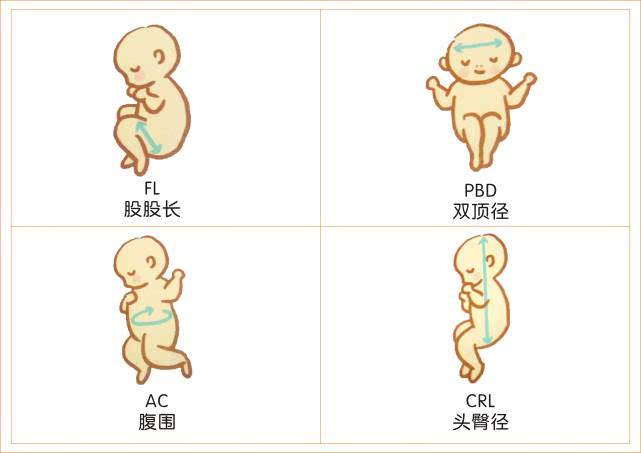 "胎位"是决定孕妇能否顺产的一个重要因素,一般来说头位是最佳胎位