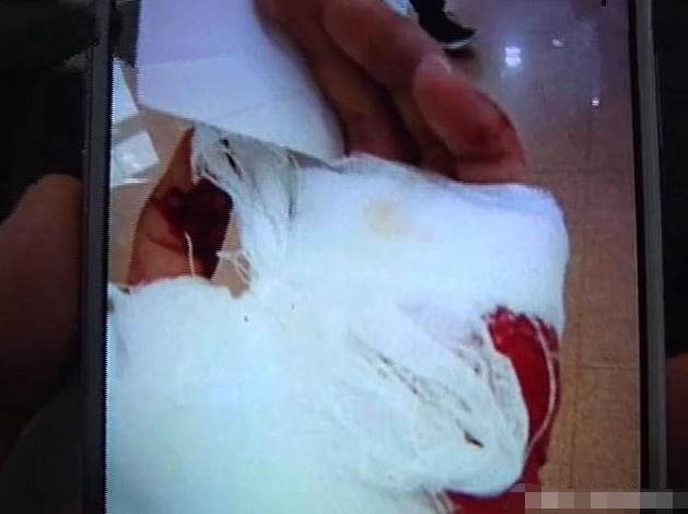 想到后来却发生了一件不愉快的事情,朋友上个厕所的功夫却受伤住院了!